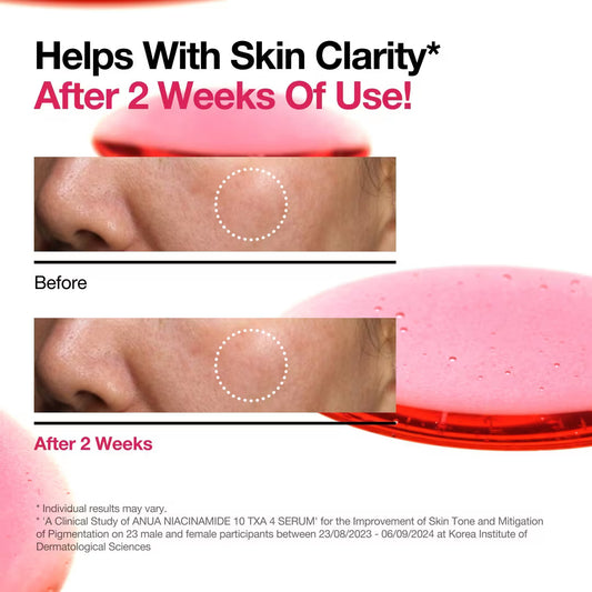 ANUA Suero Corrector de Manchas e Iluminador Niacinamide 10% + TXA 4% Serum
