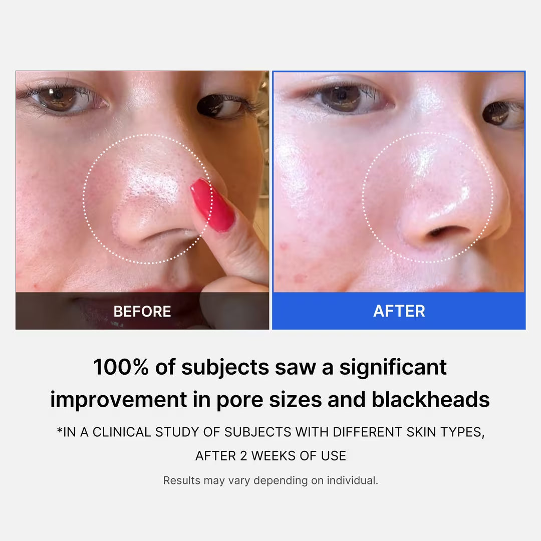 Medicube Almohadillas Tónicas Exfoliantes para Minimizar Poros Zero Pore Pad
