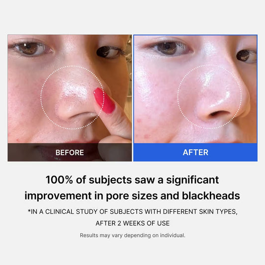 Medicube Almohadillas Tónicas Exfoliantes para Minimizar Poros Zero Pore Pad